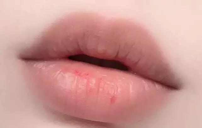 精油潤唇膏