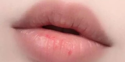 精油潤唇膏